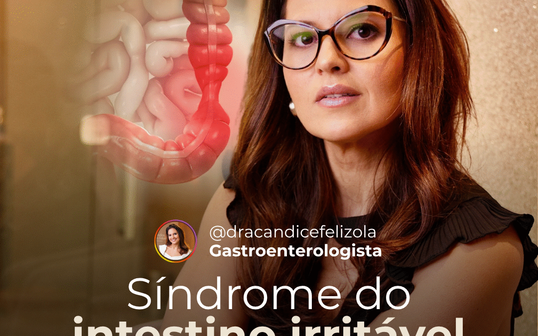 Síndrome do Intestino Irritável (SII): Entenda, Reconheça e Encontre o Caminho para o Alívio com a Dra. Candice Felizola